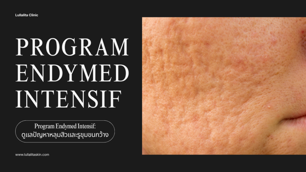 Endymed intensif