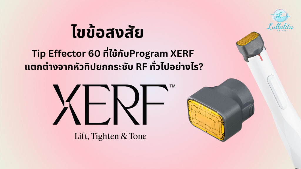 XERF ต่างจาก RF อย่างไร Tip Effector 60 คืออะไร เครื่อง XERF ยกกระชับ ยกกระชับหน้า คลื่นความถี่วิทยุ Dual Frequency RF