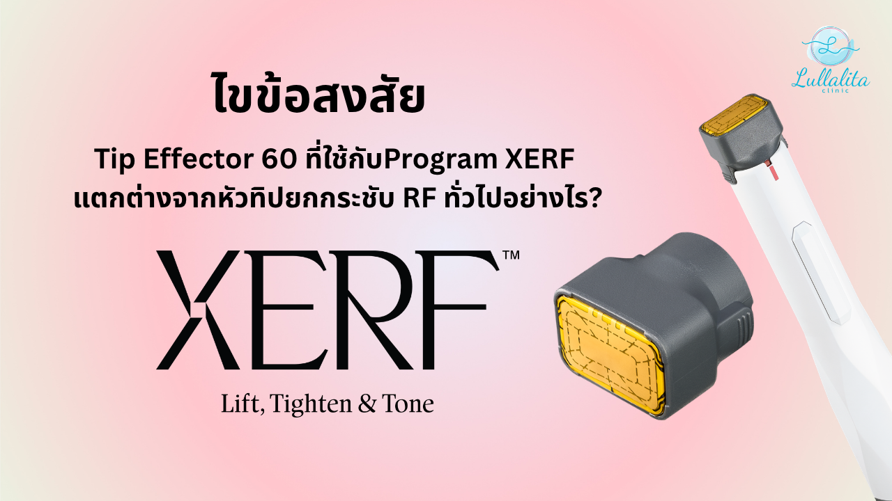 XERF ต่างจาก RF อย่างไร Tip Effector 60 คืออะไร เครื่อง XERF ยกกระชับ ยกกระชับหน้า คลื่นความถี่วิทยุ Dual Frequency RF
