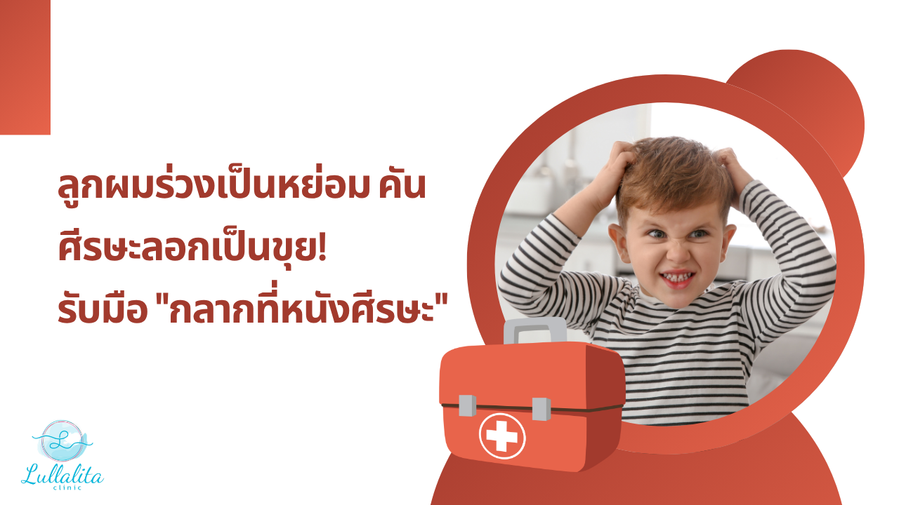 กลากที่หนังศีรษะ