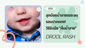 Drool rash