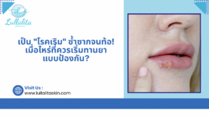 เริม