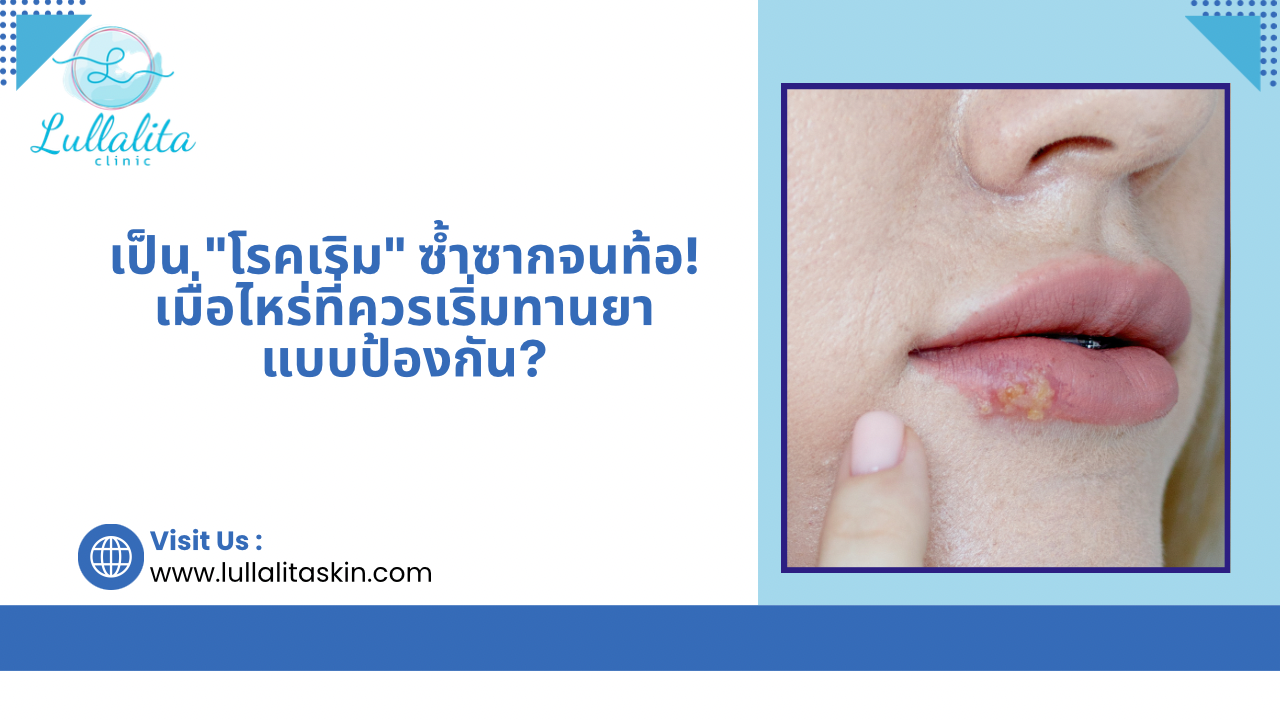 เริม