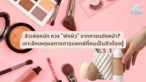 สิวเห่อหนัก ควร "พักผิว"