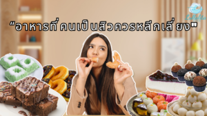อาหารที่คนเป็นสิวควรหลีกเลี่ยง