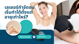 เลเซอร์กำจัดขน