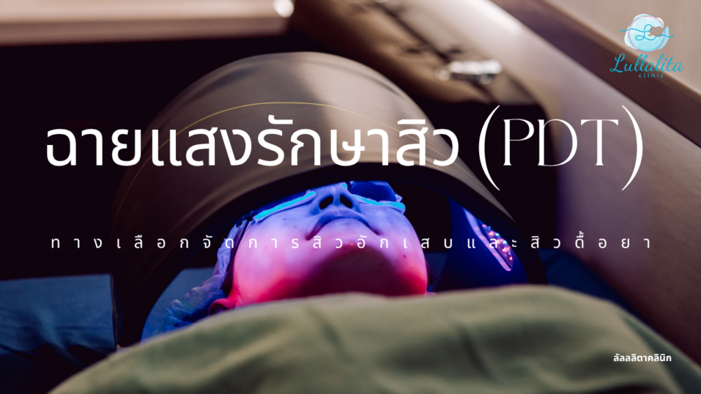 แสงรักษาสิว