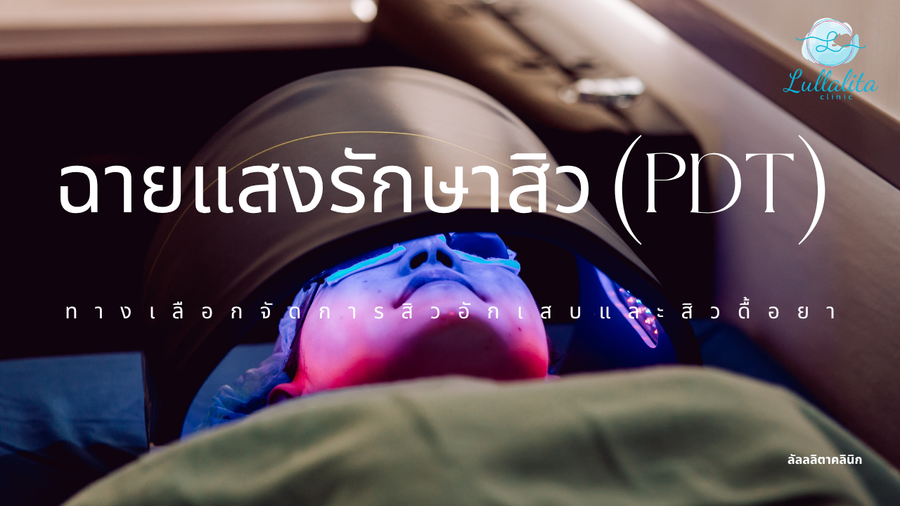 แสงรักษาสิว
