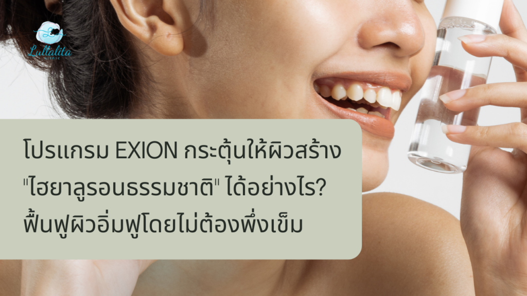 Exion