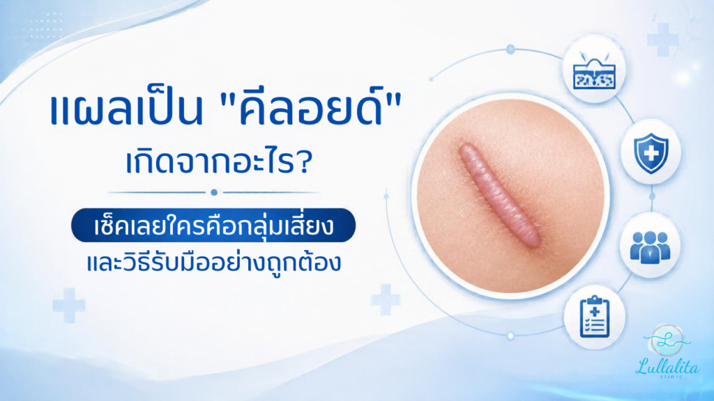 Keloid