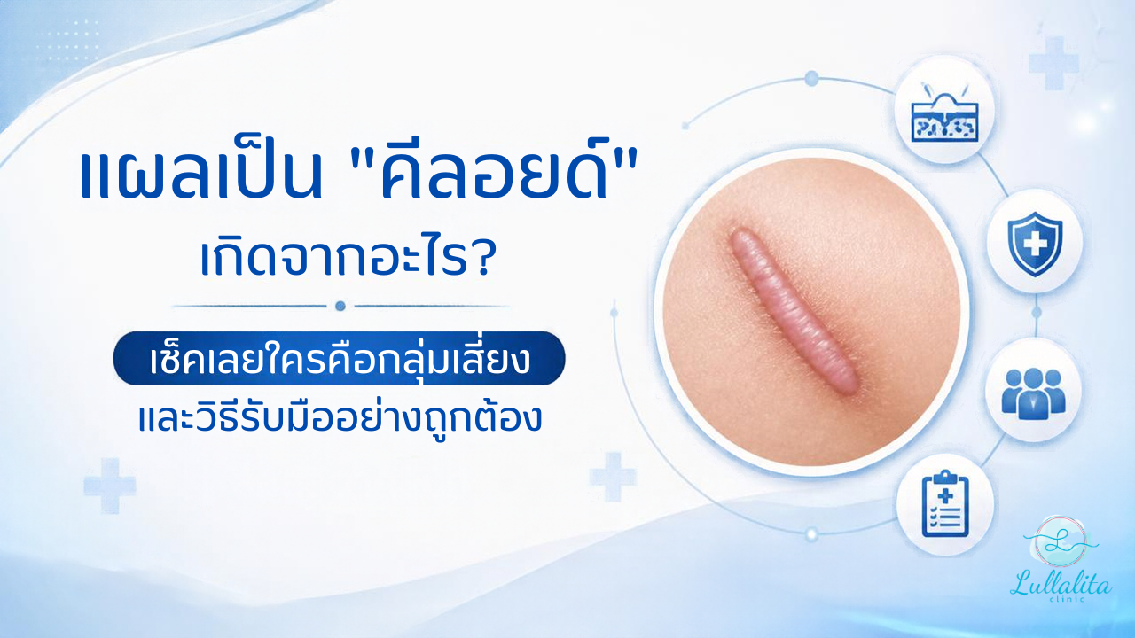 Keloid