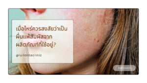 ผื่นแพ้สัมผัส