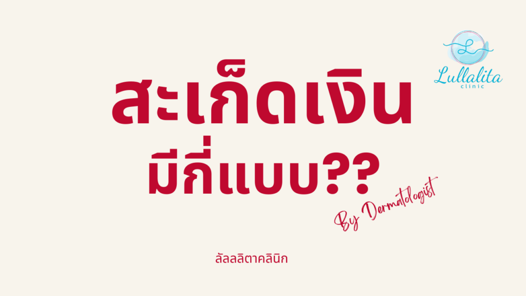 สะเก็ดเงิน