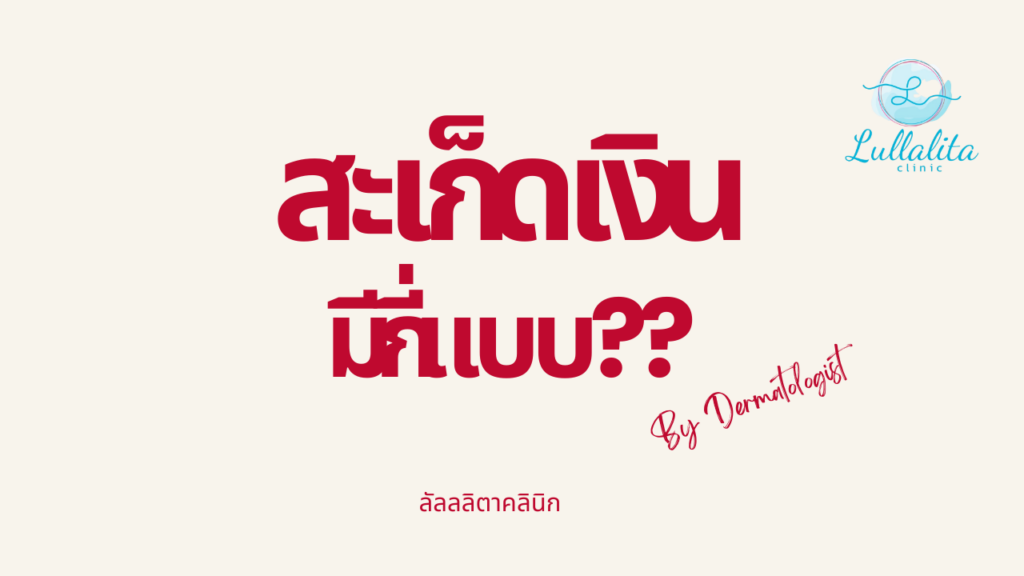 สะเก็ดเงิน