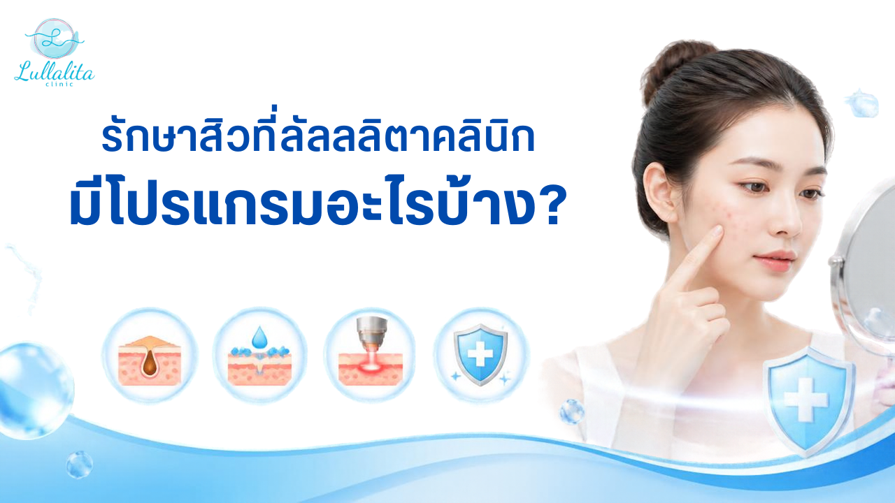 รักษาสิว