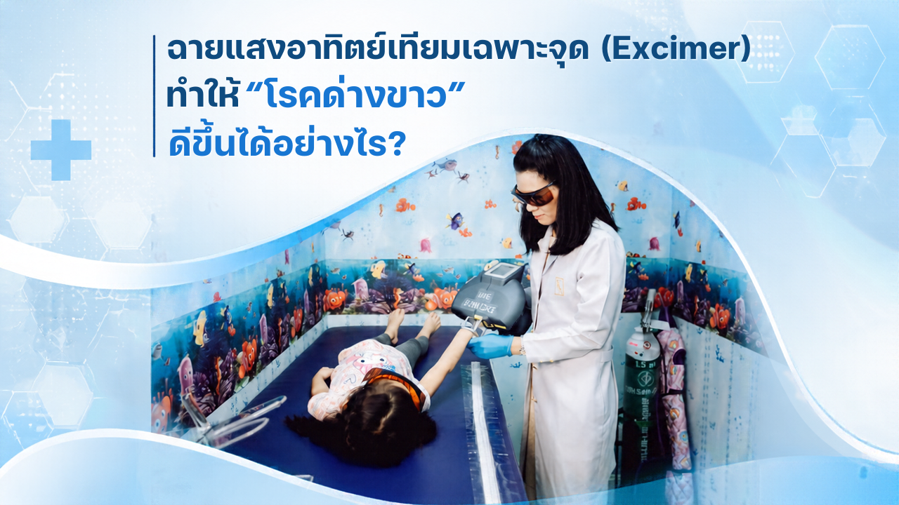 ฉายแสงอาทิตย์เทียมเฉพาะจุด (Excimer) ลัลลลิตาคลินิก